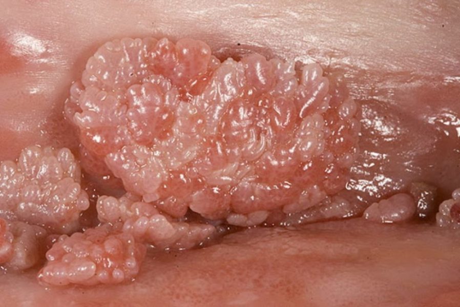 11-1-898x600-3457580