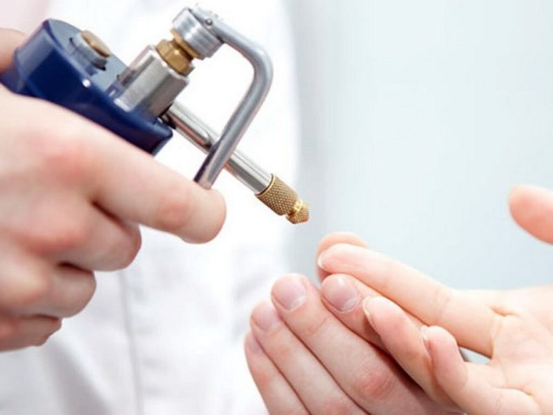 borodavka-pod-nogtem-prichiny-poiavleniia-i-lechenie5-800x600-3060704