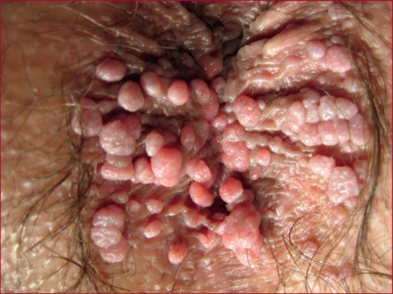 texte_alt_jlehpg0951gr1-1-801x600-3043036