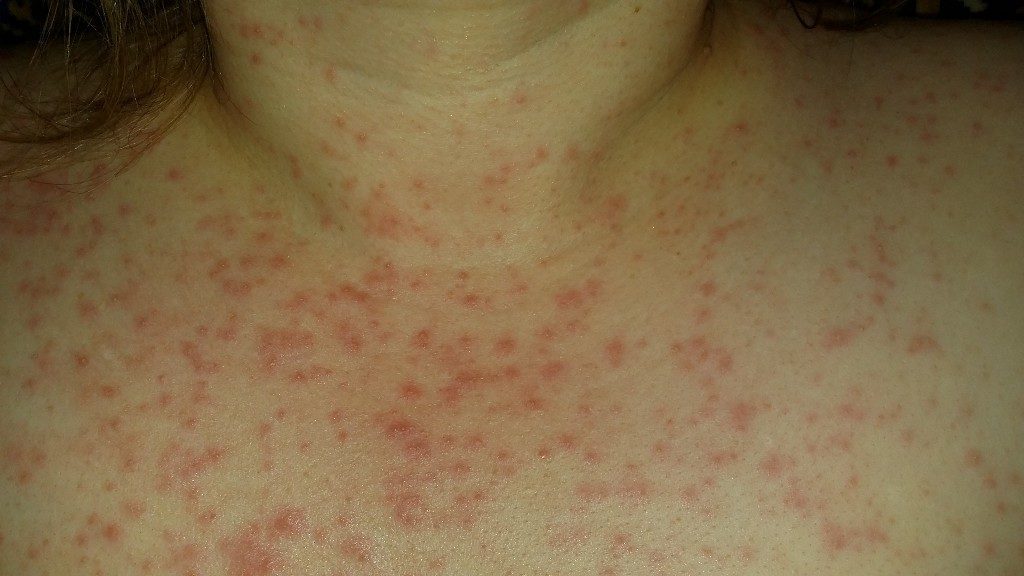 d0bfd180d18bd189d0b8-d0bdd0b0-d0b3d180d183d0b4d0b82-1024x576-5742982