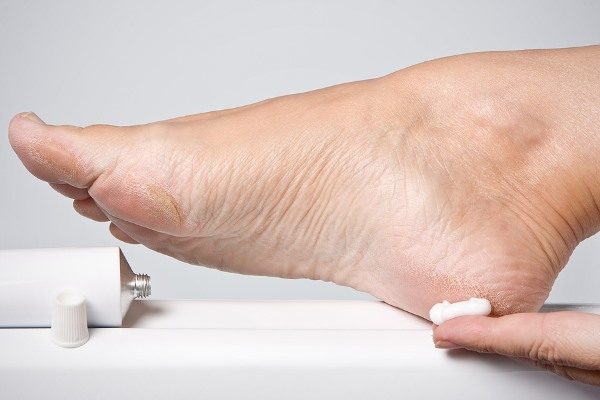 maz-ot-podoshvennyh-borodavok-2896884