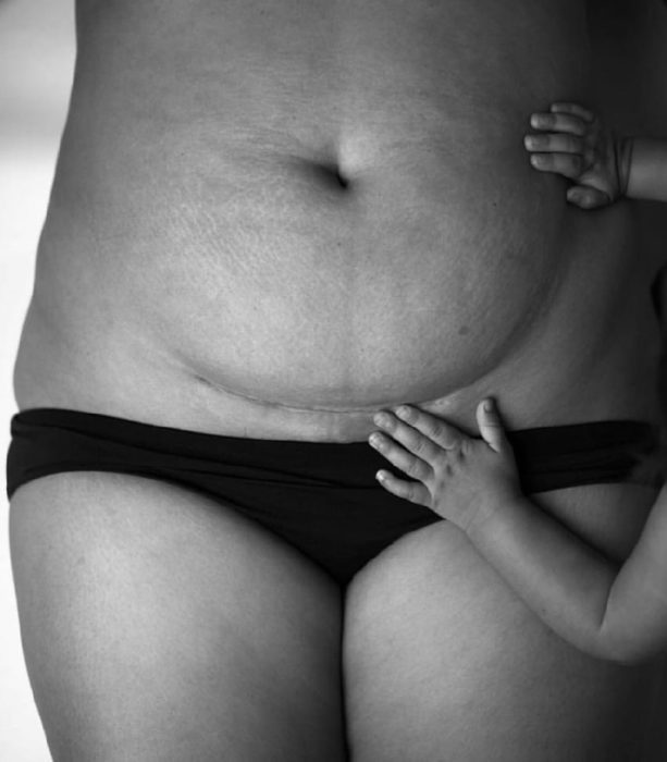 bolshoy-zhivot-posle-kesareva-613x700-7782177