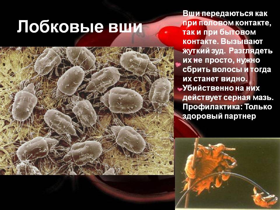 d09bd0b5d187d0b5d0bdd0b8d0b5-d0b8-d0bfd180d0bed184d0b8d0bbd0b0d0bad182d0b8d0bad0b0-d0bbd0bed0b1d0bad0bed0b2d0bed0b3d0be-d0bfd0b5d0b4d0b8d0bad183d0bbd0b5d0b7d0b0-5019676