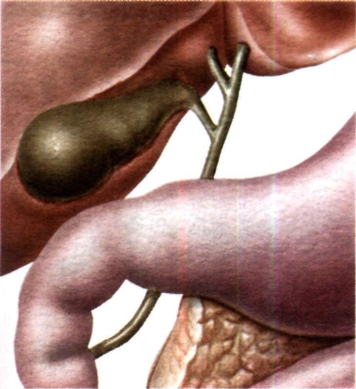 vospaleniya-zhelchnogo-puzyirya-8638565