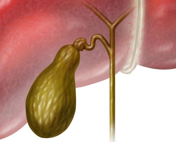 zastoj-zhelchi-v-zhelchnom-puzyre-700x566-2458756