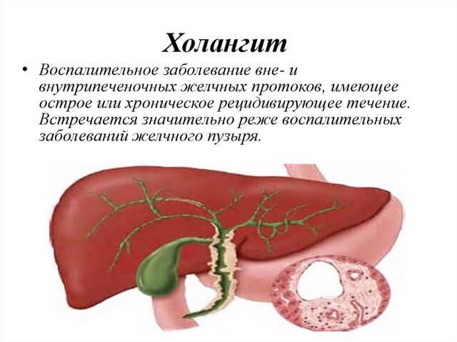 zhelchnyj-puzyr-simptomy-zabolevanija10-9798521