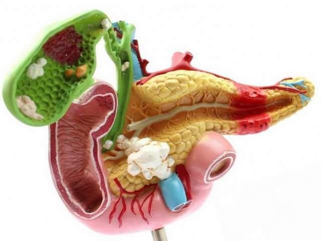 zhelchnyj-puzyr-simptomy-zabolevanija5-4450239