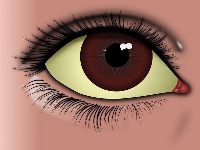 zhelchnyj-puzyr-simptomy-zabolevanija6-7904608