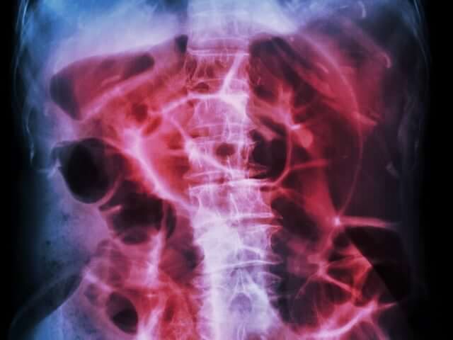 zhelchnyj-puzyr-simptomy-zabolevanija7-3724075