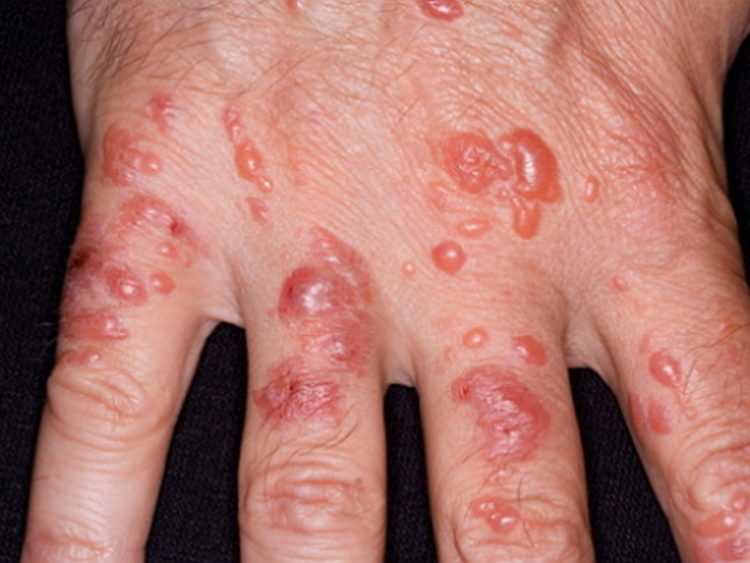 03-2-750x563-1925719