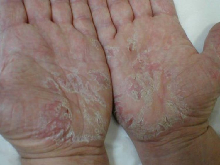 04-2-750x563-6300646