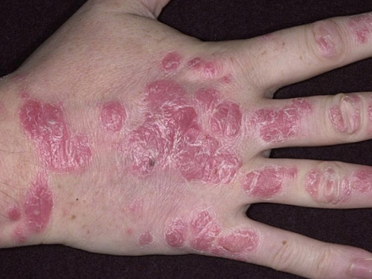 04-5-750x563-6947032