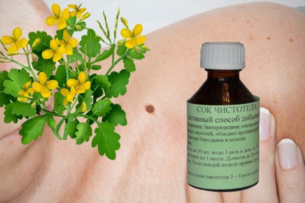 chistotel-ot-papillom-3350813