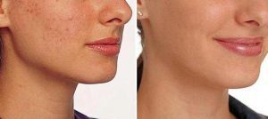 dlya_chego_ispolzovat_maz_vishnevskogo_9-300x134-8561222