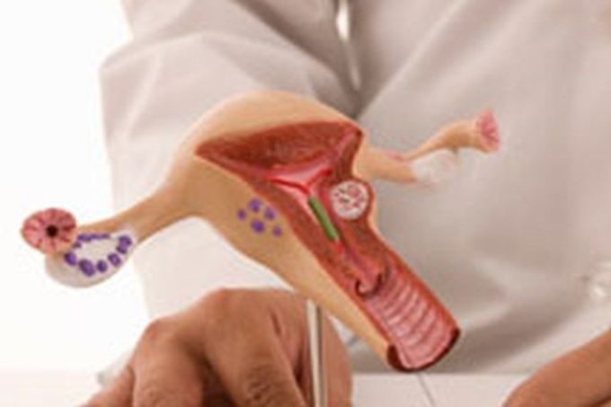 pochemu-idut-obilnie-mesyachnie-so-sgustkami-2698130