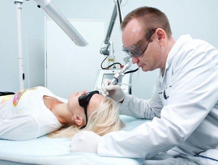 lazernoe-udalenie-pappilom-8027428